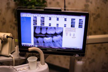 tooth imaging